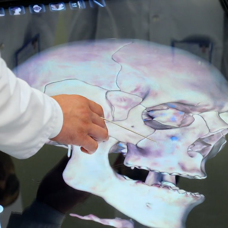 Kelle&ccedil;anagyň esasy. G&ouml;zhana, burun boşlugy we agyz boşlugy. Anatomage 3D enjamynda amaly sapak